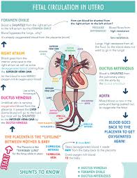 Image result for Delayed Transition from Fetal Circulation
