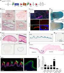 Symptoms of early stomach cancer can be similar to the symptoms of other conditions, such as stomach ulcers. Immunomodulatory Role Of Keratin 76 In Oral And Gastric Cancer Nature Communications