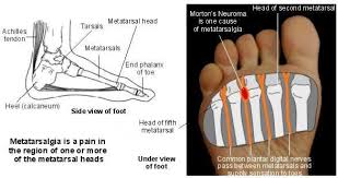Pin On Foot