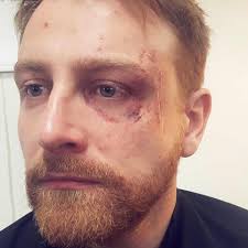 Thank you Vicky Voller for a brilliant OUT OF KIT CASUALTY Day at PAM  today! Check out these highlights from this incredible SFX Masterclass  (more