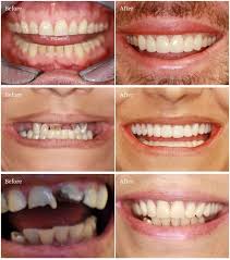 Pin On Richard W Davis Cosmetic Preventative Dentistry
