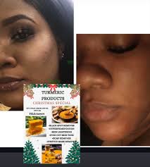 Get the family the best gift for Christmas clean that skin up for new  year!! 7269679 can call or WhatsApp