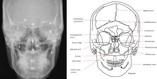 Image result for Skull XRay