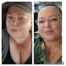 This is Me. 19.8 kilo down. 7 weeks post op. Started my journey a bit  before my OP HW 107.8 SW 101.8 CW 88kg My Goal weight is 65 /60 kg I'm