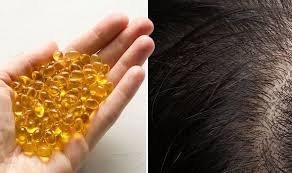 This vitamin may also help with sebum production, keeping the scalp healthier and able to. Hair Loss Treatment Stop Alopecia With Fish Oil Supplements Express Co Uk