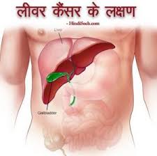 Vomit can look like undigested food, bright red blood or like dark brown coffee grounds. What Is Tumor In Stomach In Hindi