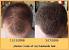 Nioxin Hair Regrowth Treatment