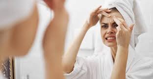 Acne Solar Como Fugir De Cravos E Espinhas Que Aparecem Nos Dias De Calor Em 2020 Tipos De Acne Acne Cravos E Espinhas