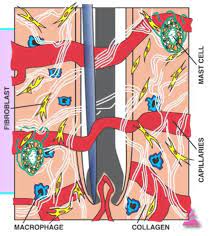 Everything you need to know about electrolysis hair removal. Hair Removal Electrolysis Aftercare 2pass Clinic