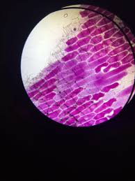 Maybe you would like to learn more about one of these? Onion Cells Under The Microscope Under Two Conditions Sucrose Solution And Water To Investigate Plasmolysed And Turgid Cells Biology A Level
