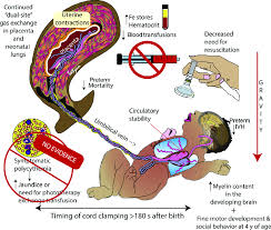 Image result for Delayed Transition from Fetal Circulation