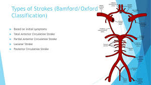 The toast 2 classification system is the most commonly used in patients a computerized algorithm for etiologic classification of ischemic stroke: Ben Ryan Final Year Medical Student Ppt Download