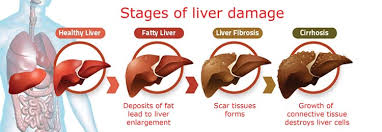 Love Your Liver Khmer Times