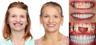 It's time to celebrate! Today is our wonderful dental hygienist Kristin's  birthday! We hope you'll join us in wishing her all the best today and in  the year ahead. Happy Birthday, Kristin!