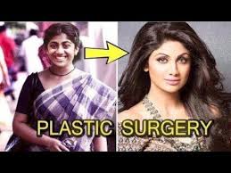 Top 5 Plastic Surgery Photos Of Bollywood Actresses Before After Youtube In 2020 Plastic Surgery Photos Plastic Surgery Surgery