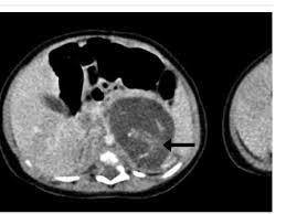 Maybe you would like to learn more about one of these? Use Of Aborted Fetal Cell Lines In Vaccines Good Or Bad World Gulf News