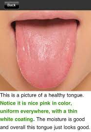 A Cool New App That Lets You Evaluate Your Health Based On Your Tongue Using Principles Of Chinese Traditional Chinese Medicine Healthy Tongue Chinese Medicine