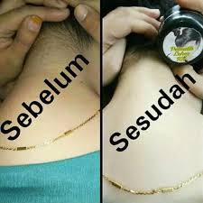 Pemakaian secara teratur dapat mengembalikan keremajaan kulit untuk hasil positif yang akan anda peroleh seusai menggunakan produk cream leher sh cosmetics bisa jadi berbeda dengan yang didapatkan oleh. Cream Pemutih Leher Selangkangan Ketiak Dan Kaki Shopee Indonesia