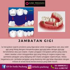 ***klik tombol dibawah utk chat dengan kami*** 2. Gigi Takde Hilang Klinik Pergigian Dr Feeliz Puchong Facebook