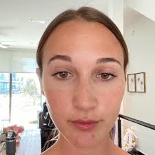 DALLAS RHINOPLASTY CENTER