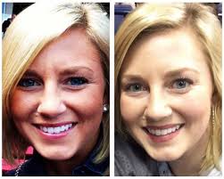 55% off, under $14, 13k+ reviews and the best thing that I have done for my  skin in years... 📎⬇️