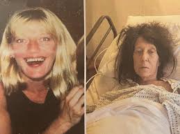 Fundraiser for Barbara Hintzen by Alan Reiff : Support Barbara's Rehab and  Recovery