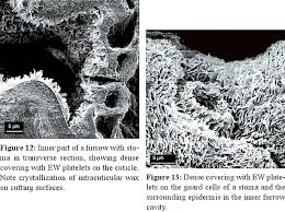 Image result for Arthraerua