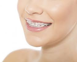It almost feels as if there is nothing on your teeth at all!… Risk Of Wearing Cheap And Fake Braces
