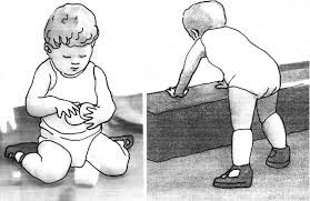 Image result for Ataxia