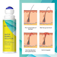 Poor hair removal methods such as rough waxing can lead to painful itching on the. Lumanere Razor Bumps Solution For Ingrown Hair Hair Inhibitor After Shave Serum Roll On For Bikini Area Legs And Underarm Area For Men And Women Pricepulse