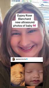 Pictures of Gypsy Pregnant