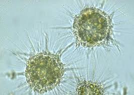 Image result for Raphidiocystis