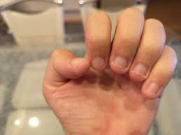 子供が爪を噛む癖が治らないのはなぜ？ ストレス？ 愛情不足？ やめさせる方法は？ | はいチーズ！クリップ