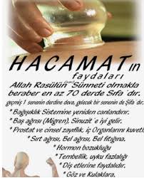 Hacamat Nedir Hacamat Nasil Yapilir Faydalari 2020 Saglikli Yasam Tarzi Sifali Otlar Saglik