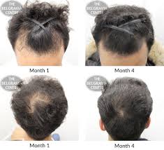 How to grow natural hair: Hair Growth Success 3 Months In And I Am Shocked At The Results