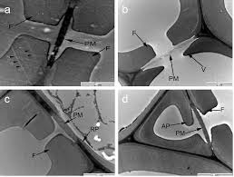 Generalized cell is used for structure of animal cell and plant cell to present the. Ultrastructure And Topochemistry Of Plant Cell Wall By Transmission Electron Microscopy Intechopen
