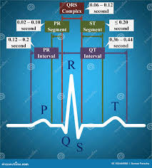 Image result for PR Interval