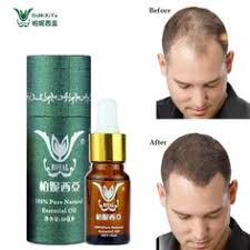 Minoxidil is the best hair growth product this is one of the most efficient and prominent hair growth products on the market both form men and women. 77 Best Hair Growth Products Ideas Hair Growth Hair Loss Hair Growth Faster