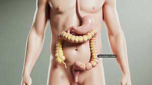 Image result for Flatulence