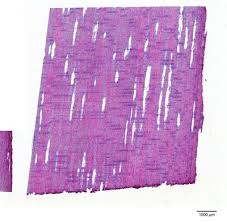 Image result for Dalbergia nitidula