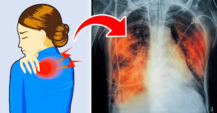 Various infections can lead to. 5 Signs Your Lungs Are Gasping For Help