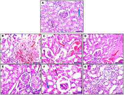 Image result for Bridelia ferruginea