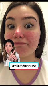 If you suffer from redness and looking for something that actually works,  give @physiogel_usa Calming Relief Cream a try, it’s a kbeauty staple for a  reason #physiogel #redness #calmingreliefcream ...