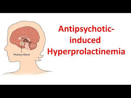 Image result for Hyperprolactinemia