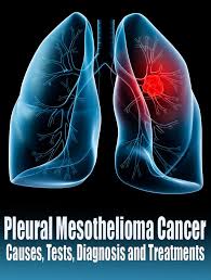 At the initial stages, most patients do not have any symptoms, with the progression of the disease only the symptoms develop. Pleural Mesothelioma Cancer Causes Tests Diagnosis And Treatments