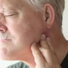 No one knows why men develop. Head And Neck Cancer Recurrence How Likely Is It