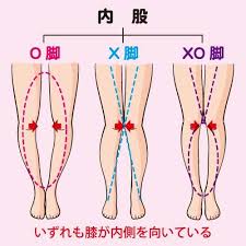 簡単に直す方法 ｏ脚治し方ガイド 腹筋のルーティン 骨盤矯正 ストレッチ ストレッチ運動