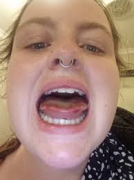 Last year around this time of year I got an upper respiratory infection. I  had one the previous year and it nearly unsubscribed me to life. I was