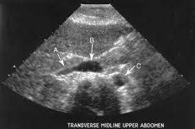 Welcome to our series of articles on small animal abdominal ultrasonography. Abdominal Vasculature Obgyn Key