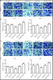 National mesothelioma law firms help families nationwide and will often travel to help file a claim. Mir 665 Is Downregulated In Glioma And Inhibits Tumor Cell Proliferation Migration And Invasion By Targeting High Mobility Group Box 1